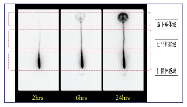 仙骨サポーターが脳下垂体を刺激